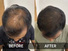 Before and after